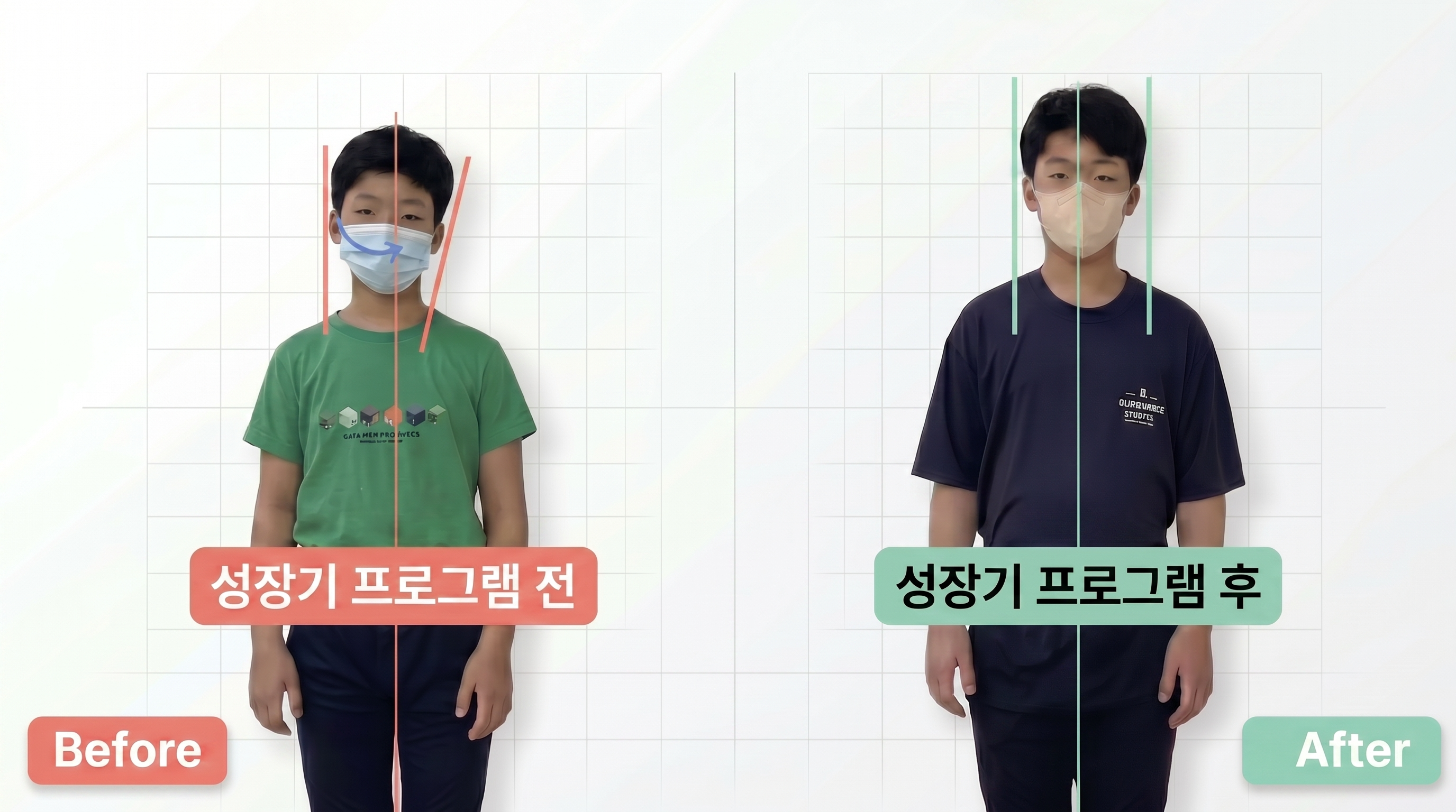 비포 애프터 1