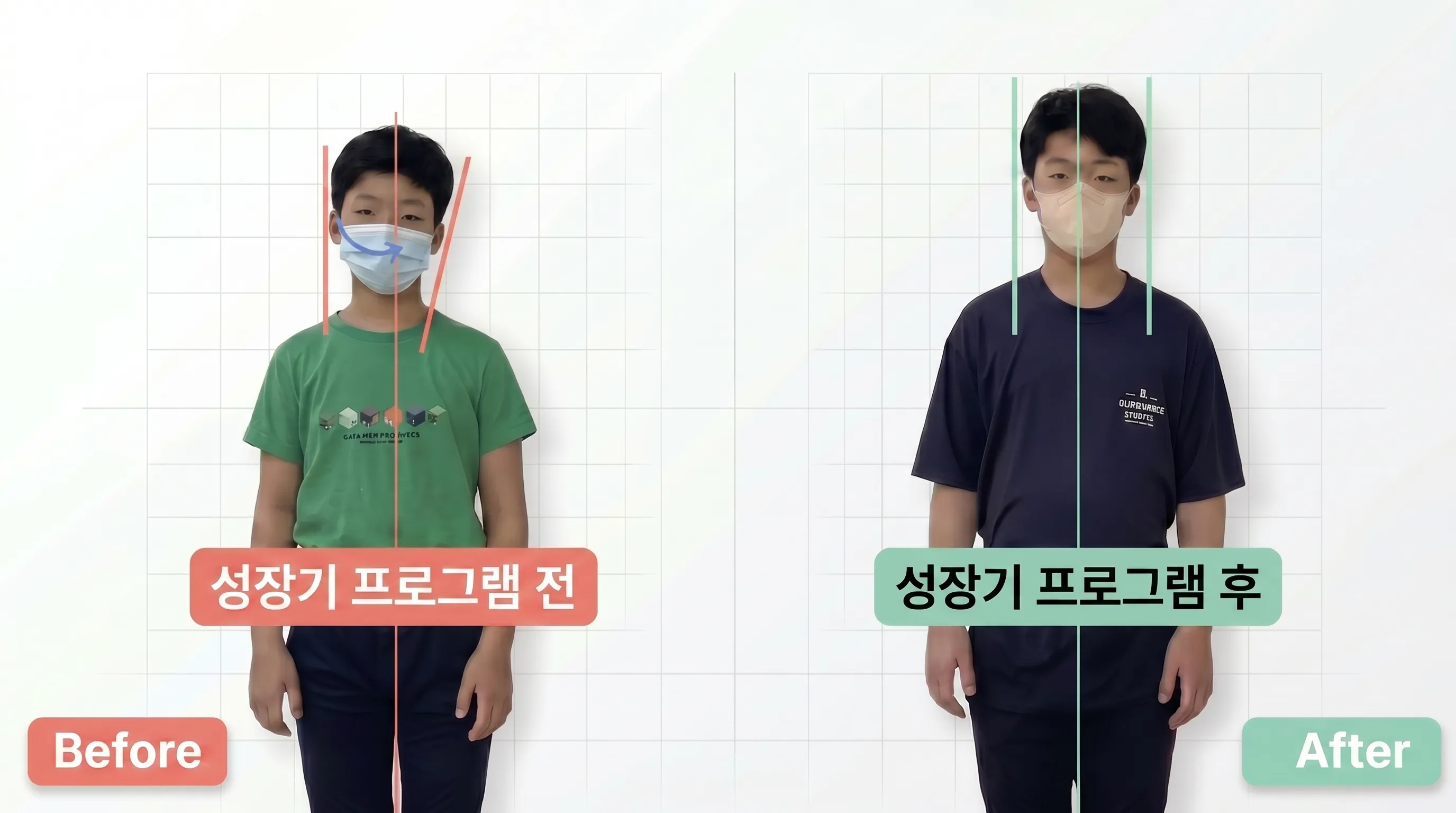 비포 애프터 1