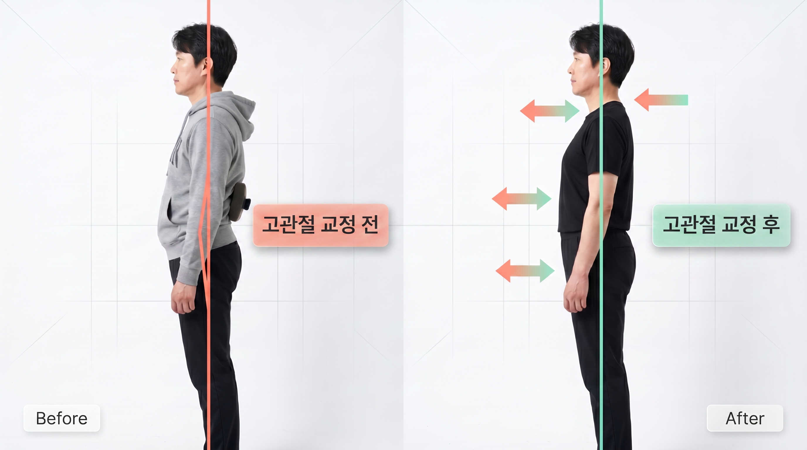 비포 애프터 10