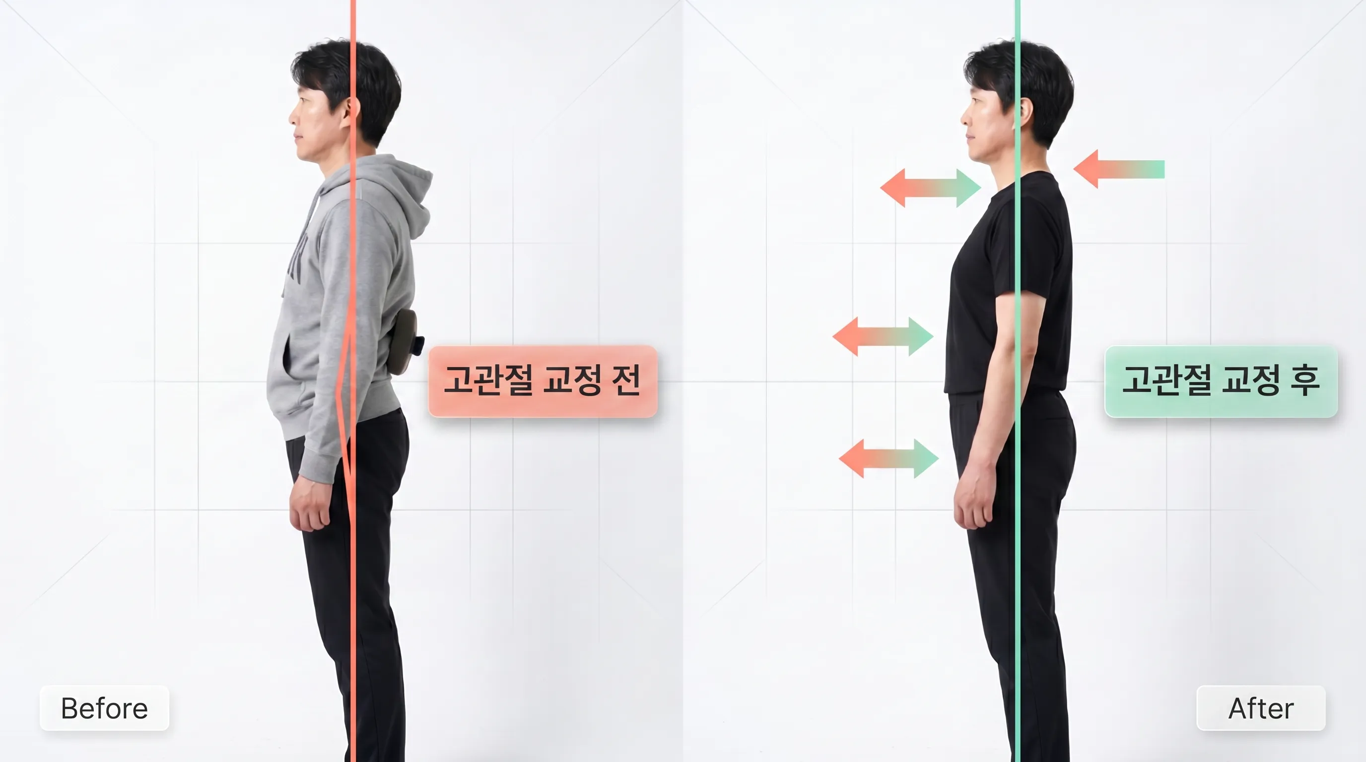 비포 애프터 10