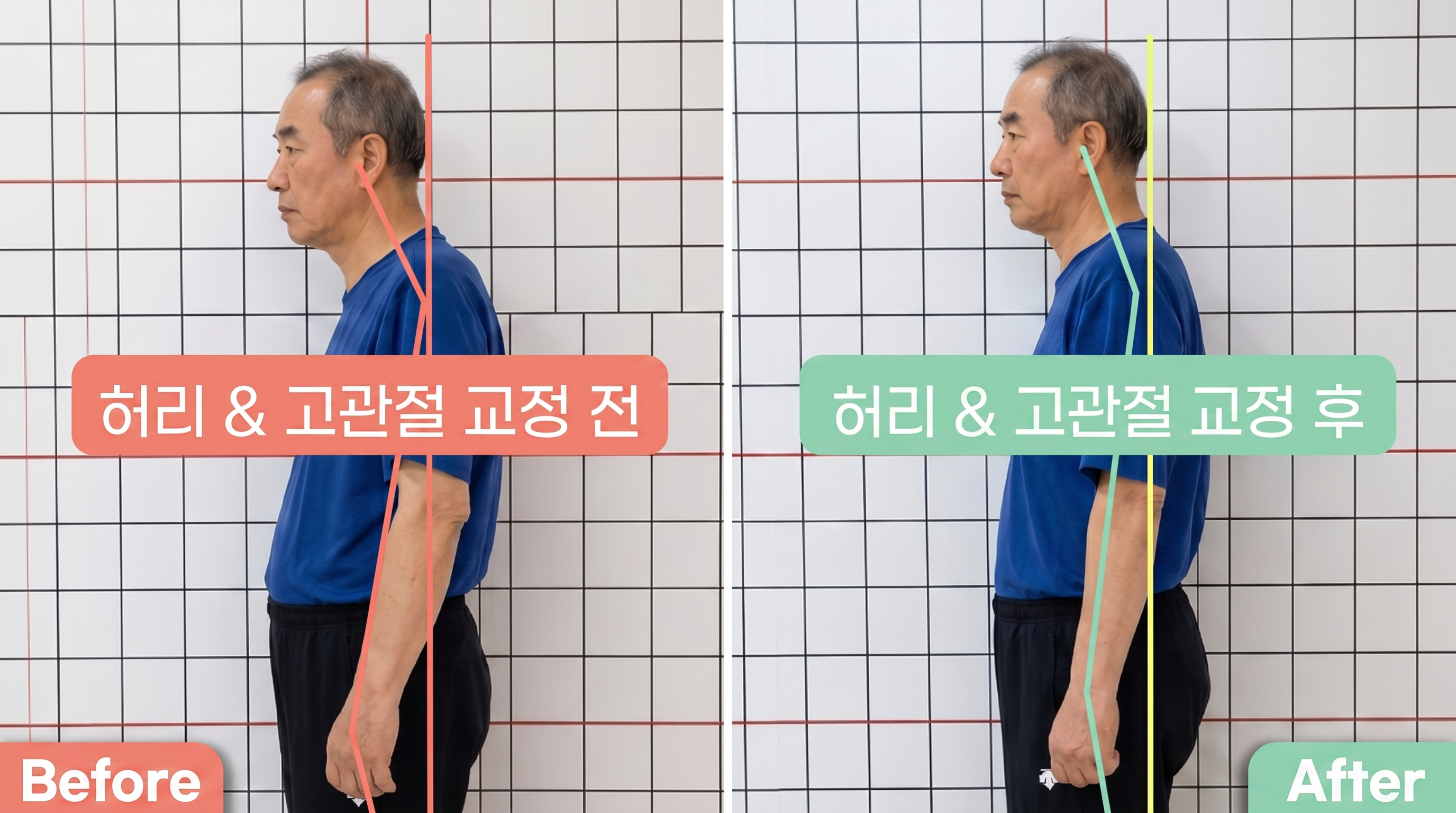 비포 애프터 11