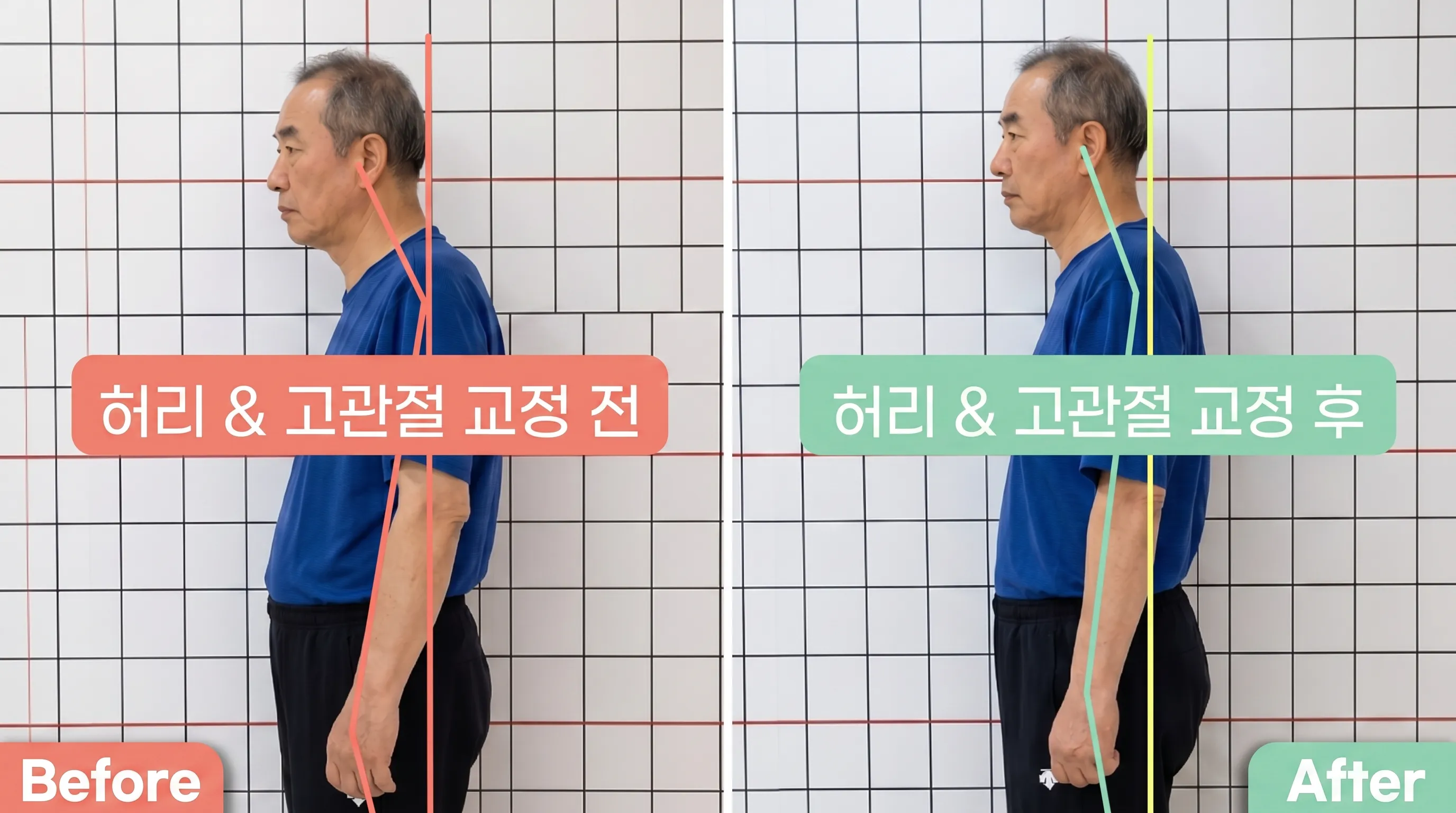비포 애프터 11