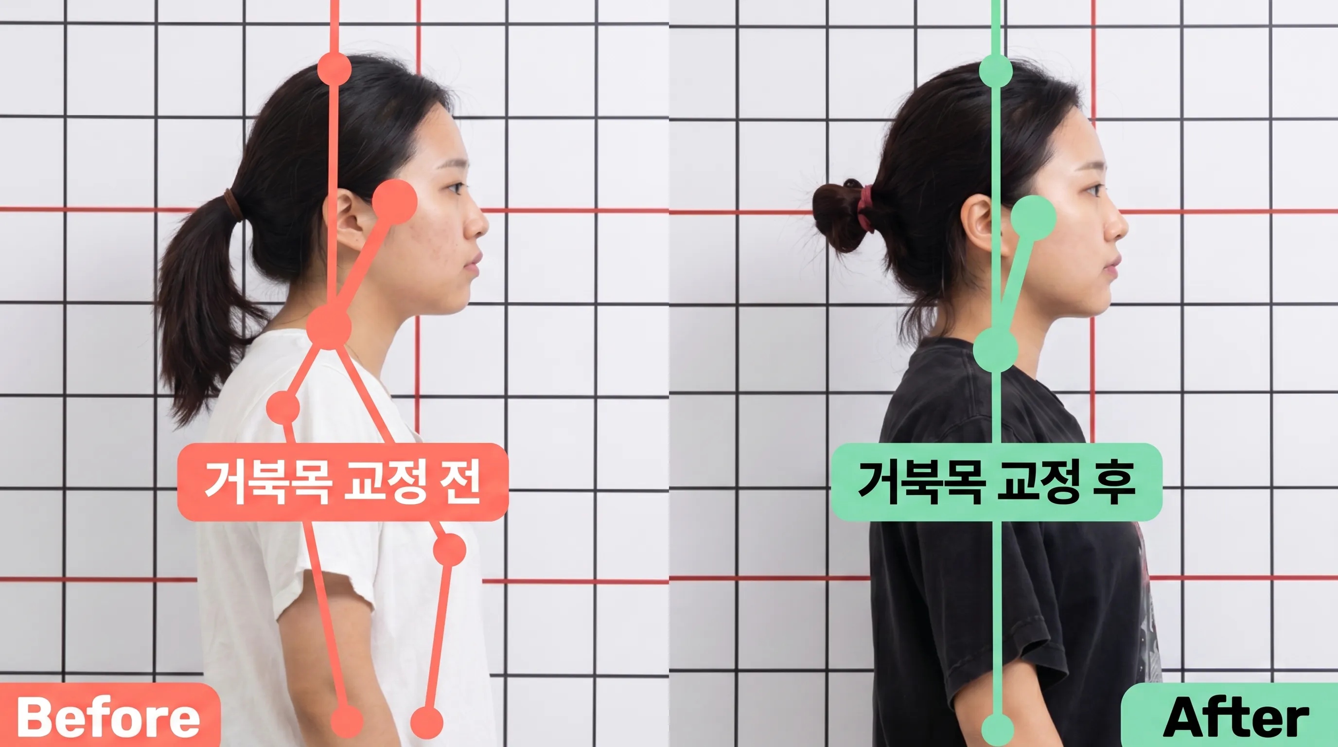 비포 애프터 15