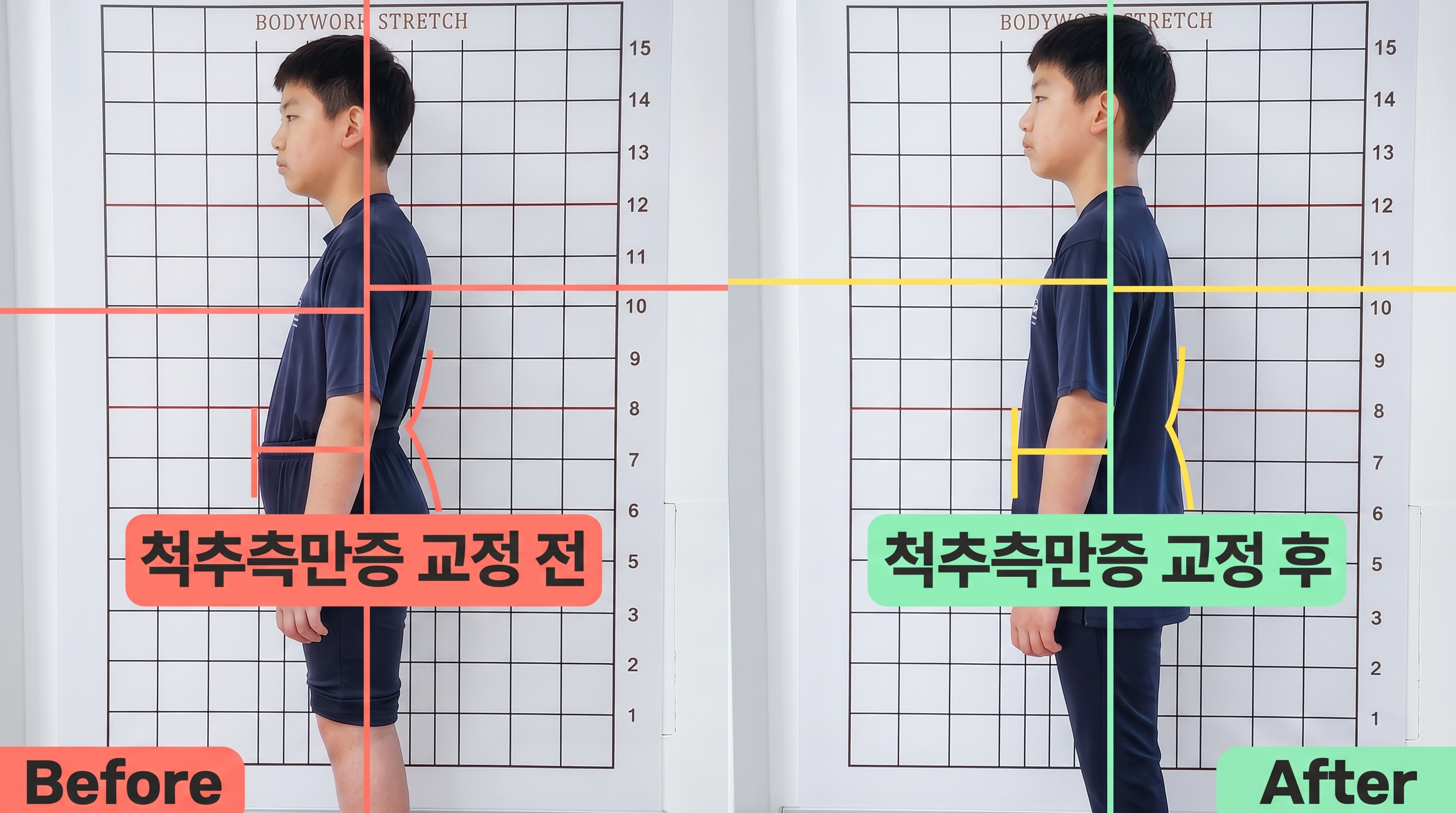 비포 애프터 2