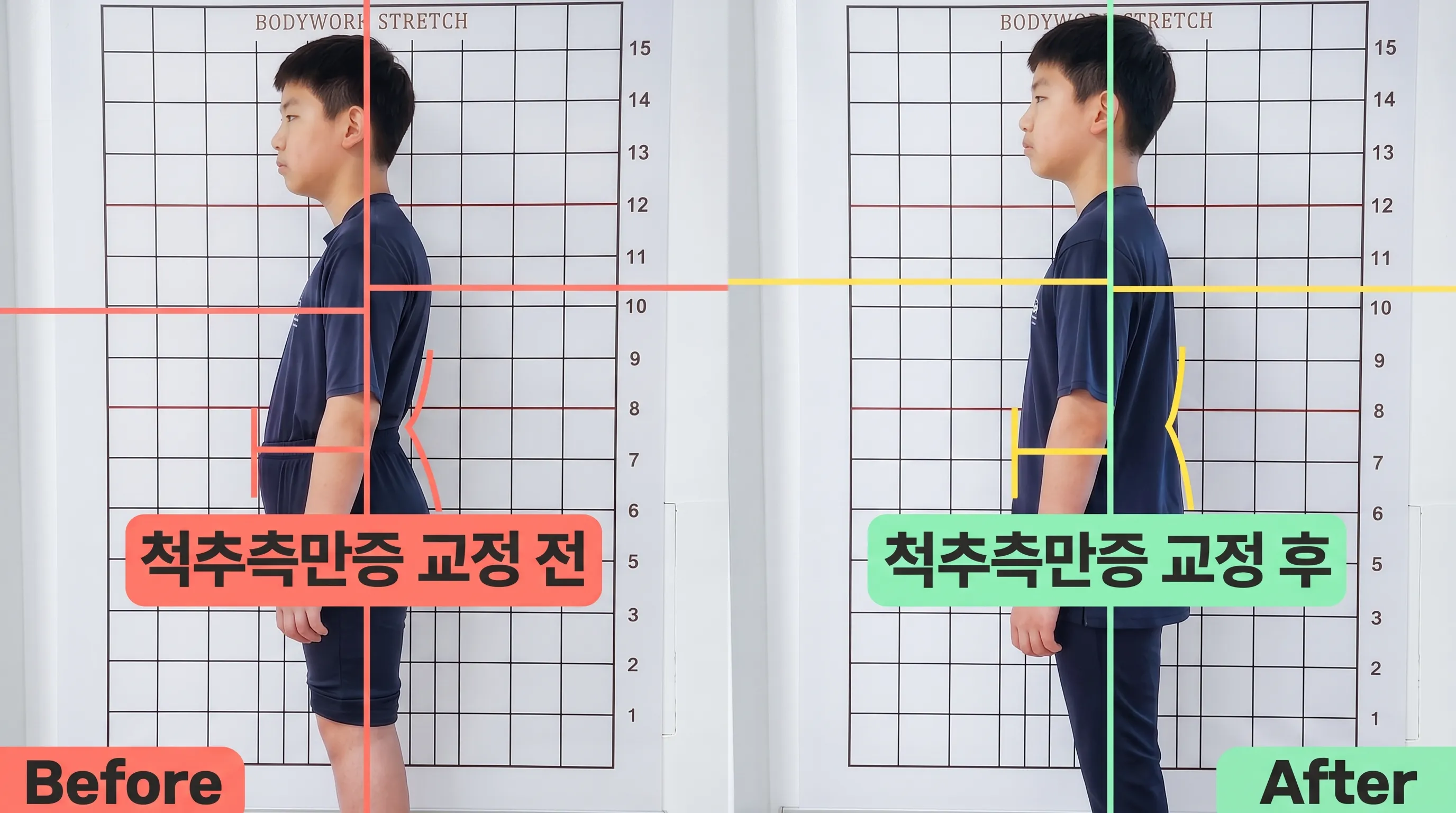 비포 애프터 2