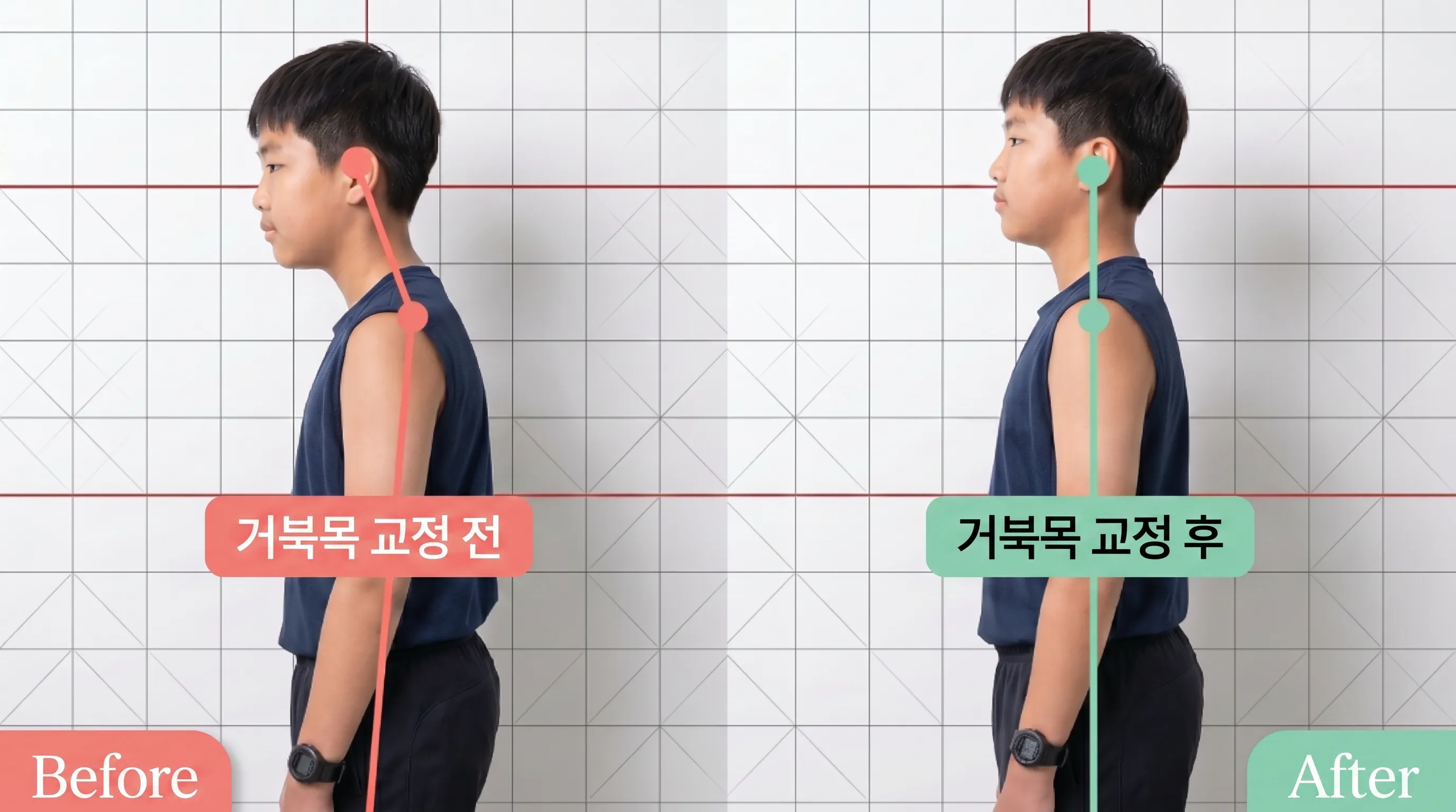 비포 애프터 3