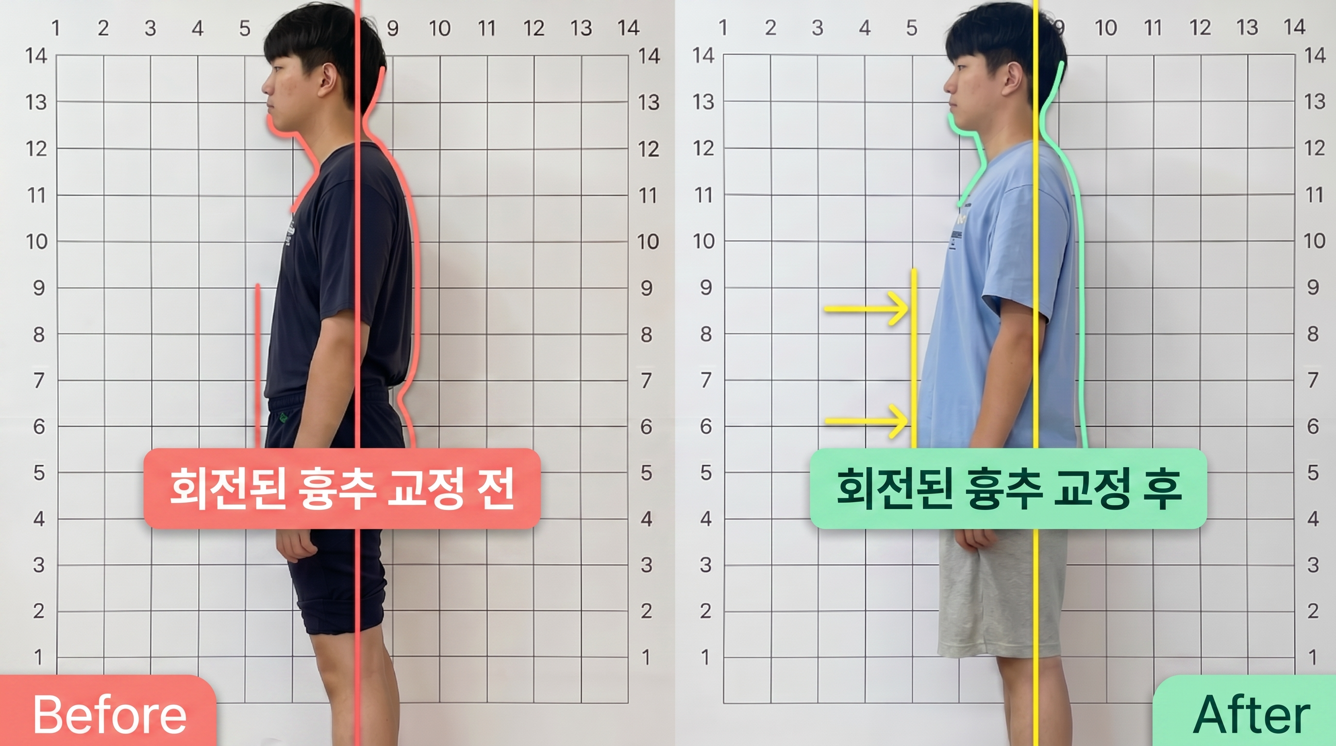 비포 애프터 5