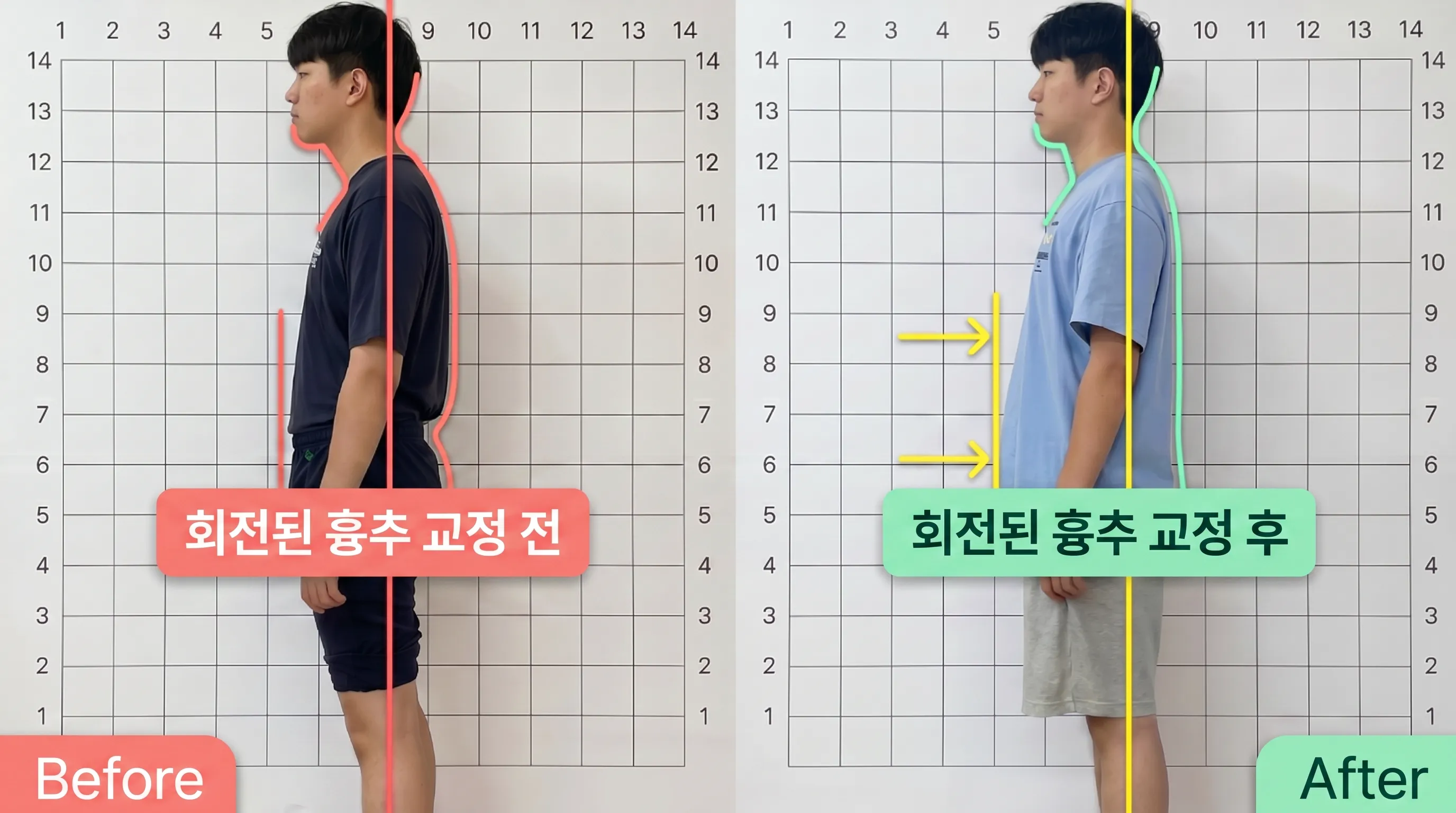 비포 애프터 5