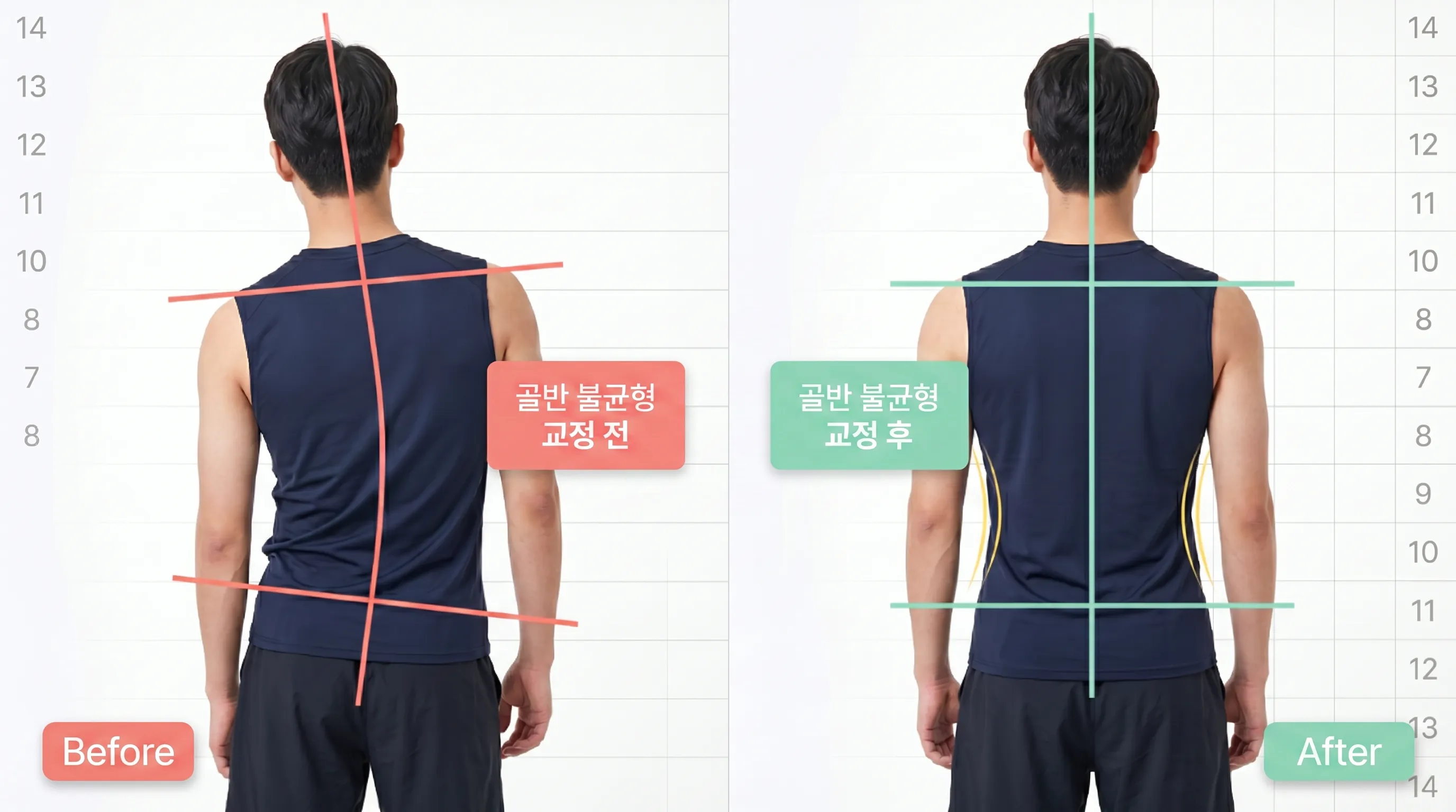 비포 애프터 6