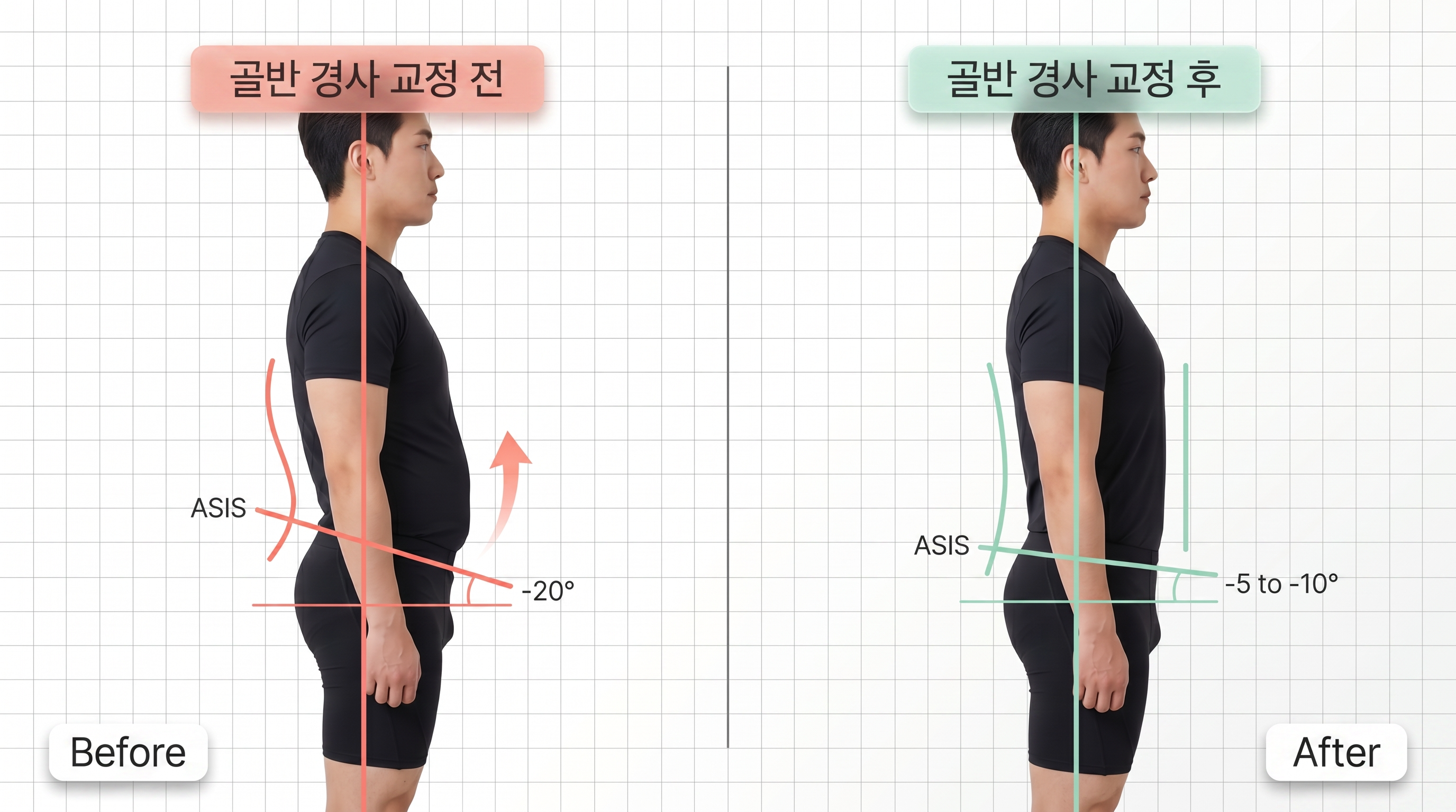 비포 애프터 8