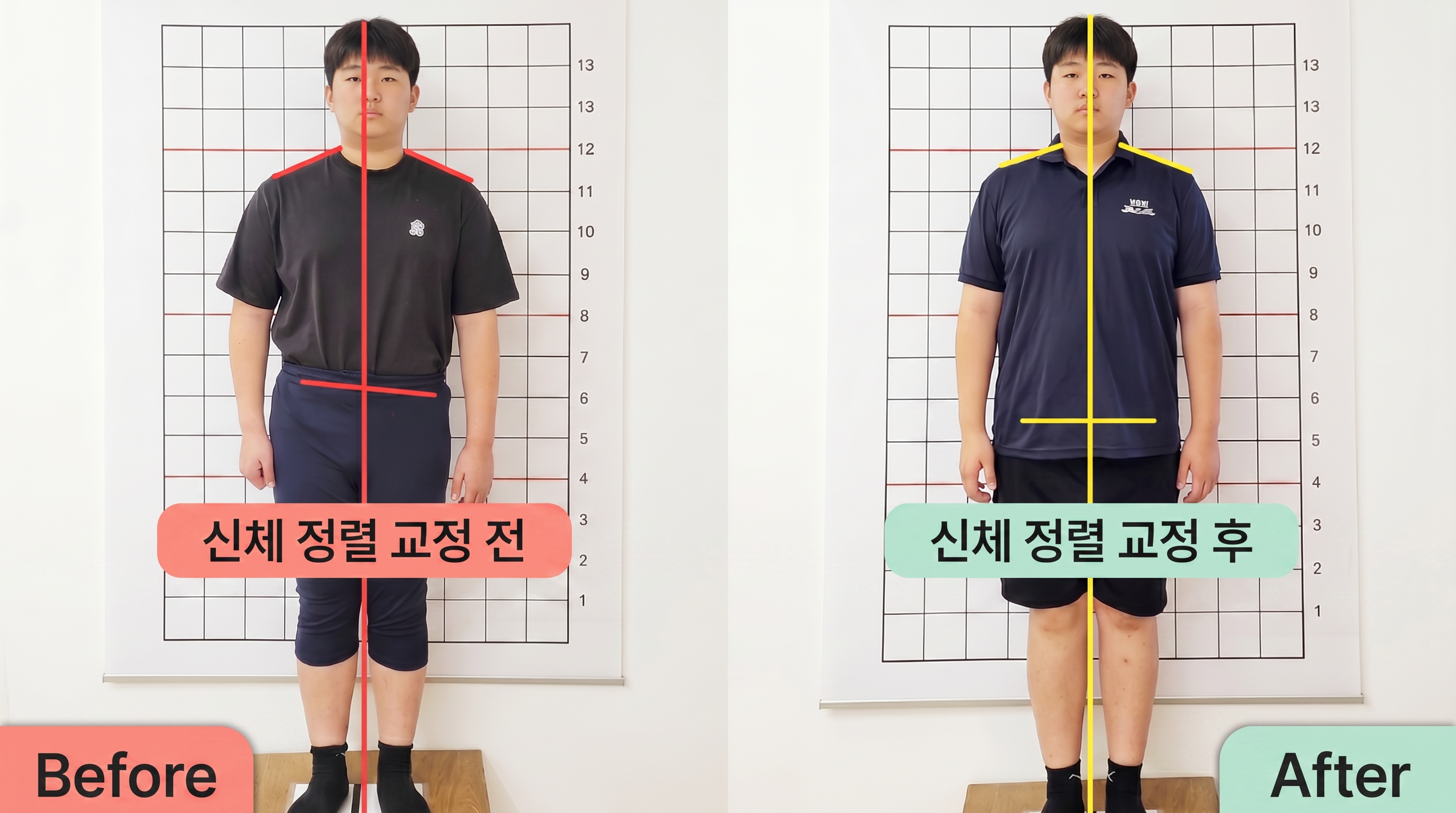 비포 애프터 9