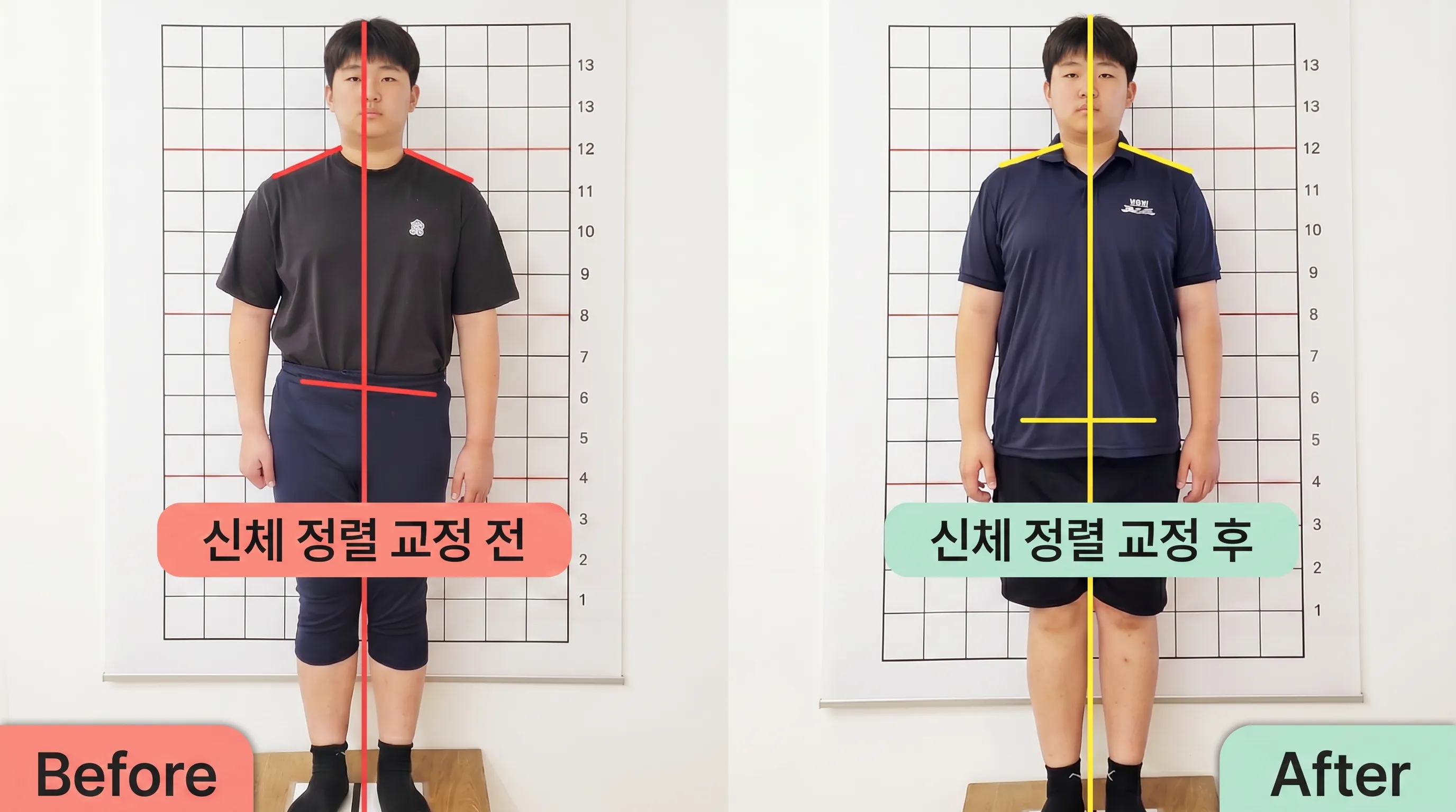 비포 애프터 9